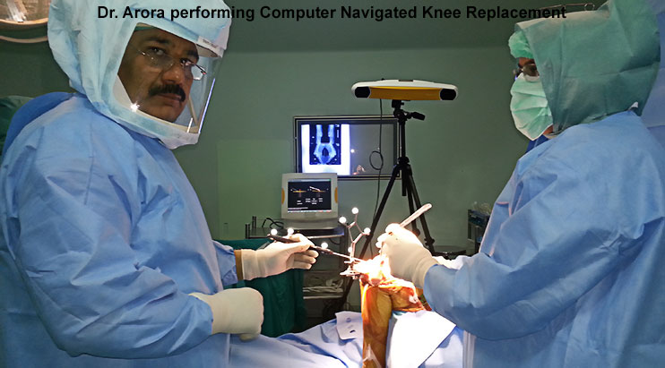 Dr. Arora performing computer assisted knee replacement
